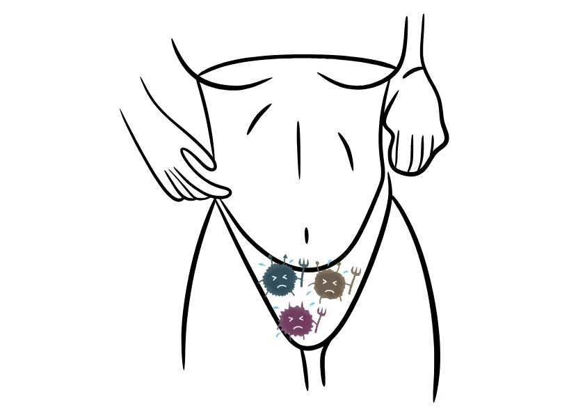 陰道細菌感染或陰道發炎